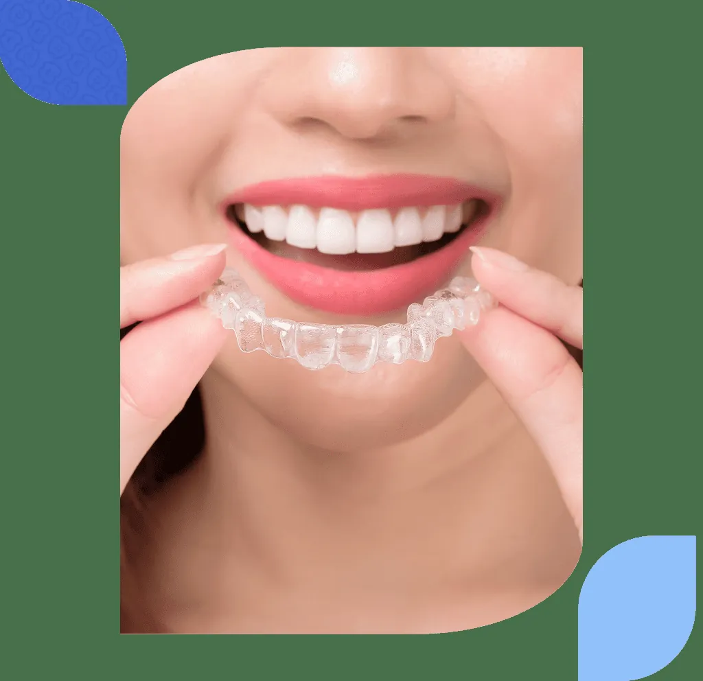 Image accompanying the article: Smile design in Bilbao