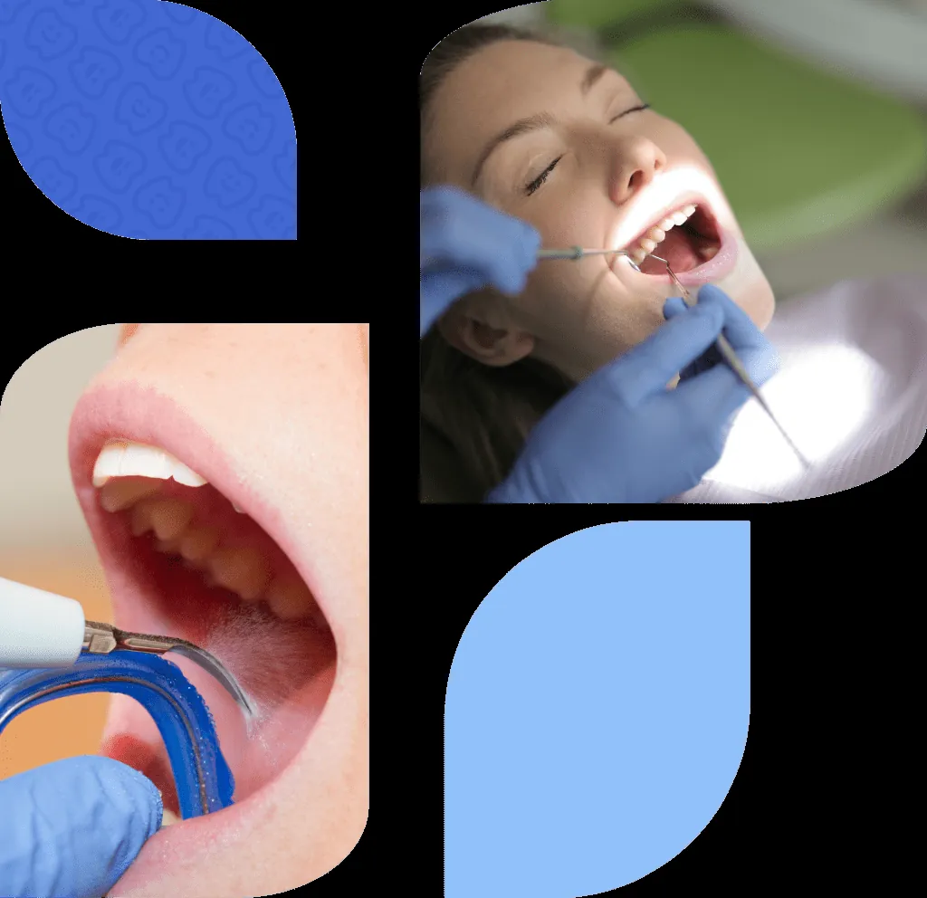 Image accompanying the article: Dental cleaning in Las Arenas