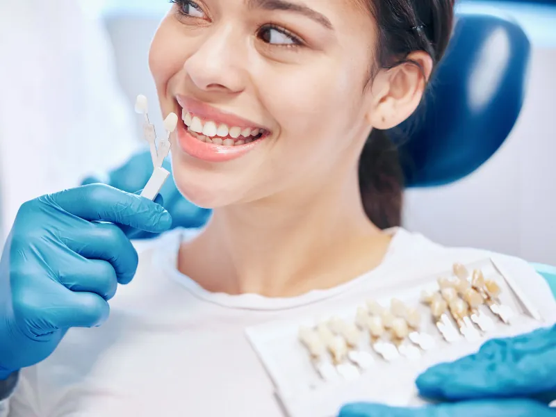 Carillas Dentales: Qué son