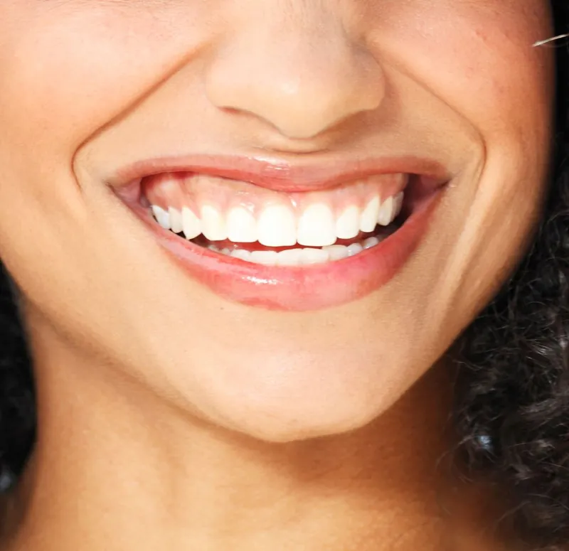 Sonrisa gingival: causas y soluciones