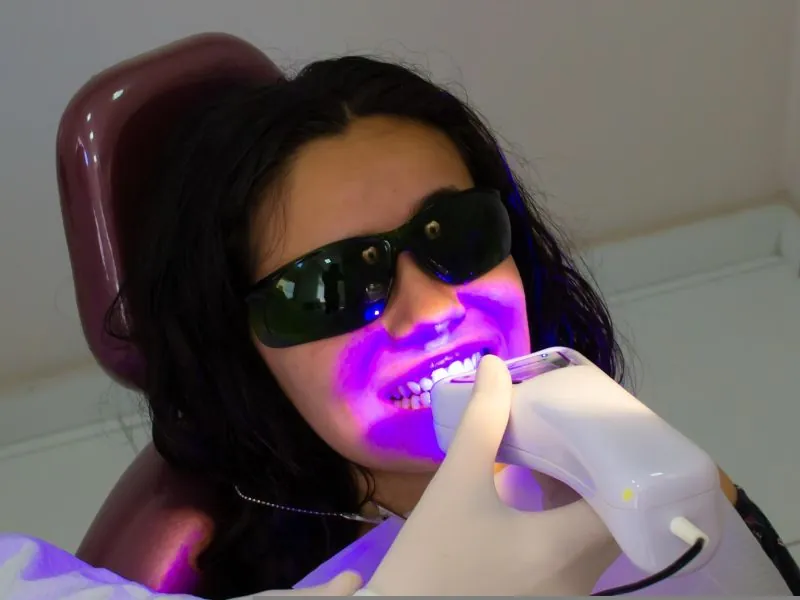 like whitening your teeth