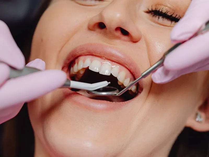 dental cleaning in Spain