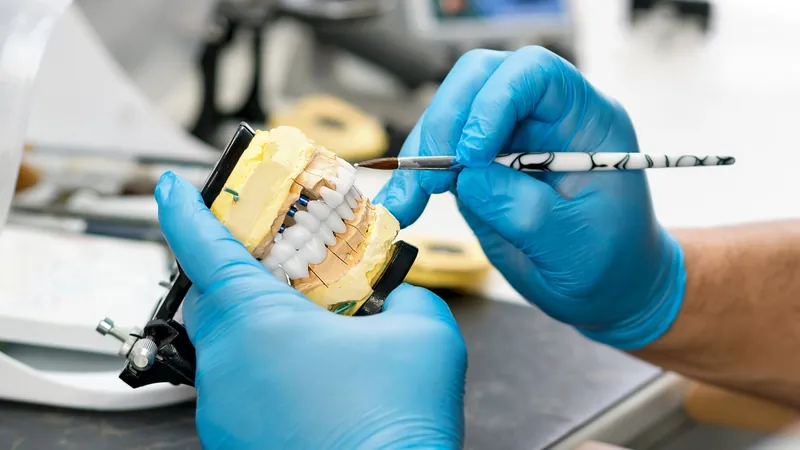 Tipos de prótesis dentales