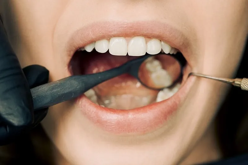 Endodoncia vs. Periodoncia: Diferencias, ventajas y cuándo es necesario cada tratamiento