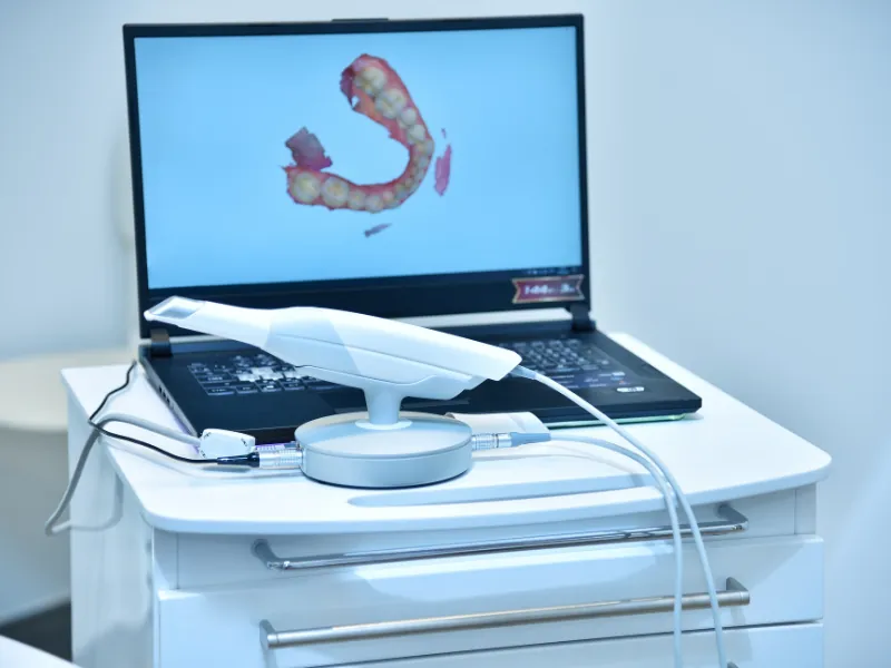 Escáner 3D e Invisalign: ¿Cómo funciona el escáner intraoral 3D y cómo diseña tu sonrisa antes de empezar la ortodoncia?