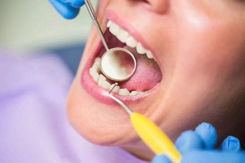 dental examination