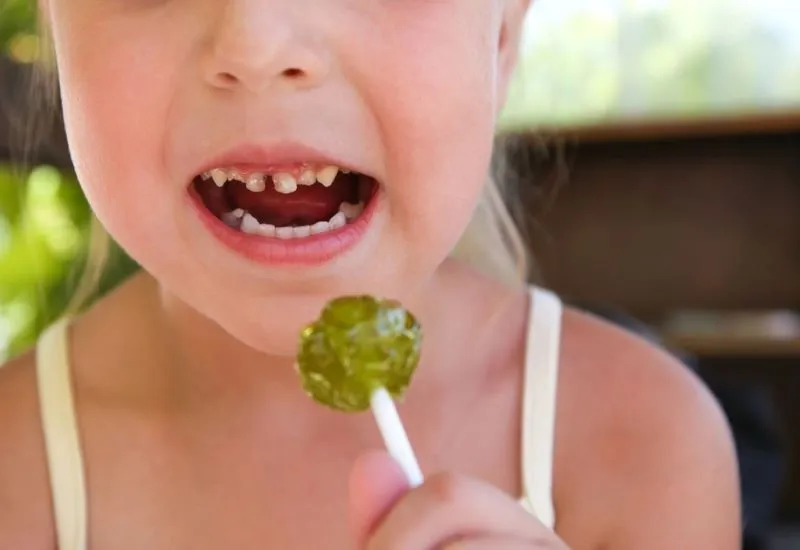 caries dientes de leche