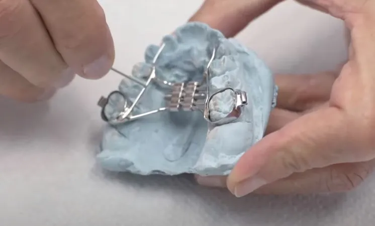 expansionary circuit breaker to treat narrow palate