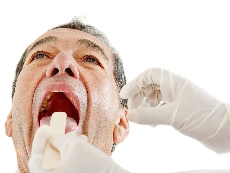 symptoms-flemon-bucal