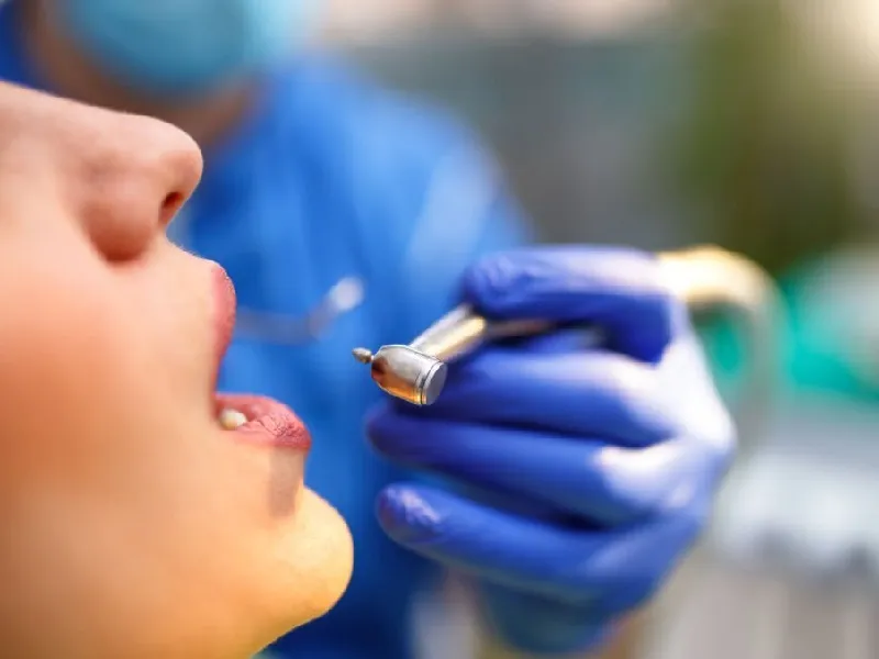 Tooth filling off
