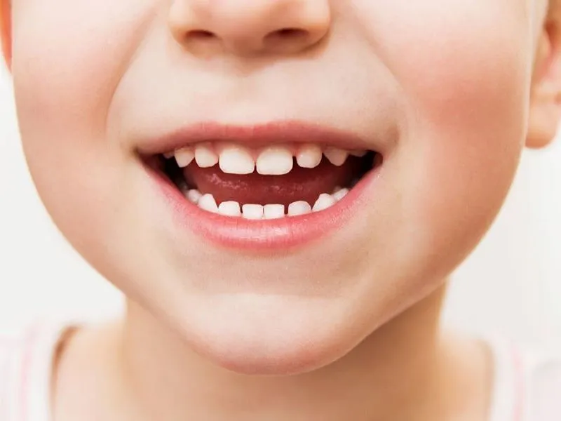 How many teeth of milk we have