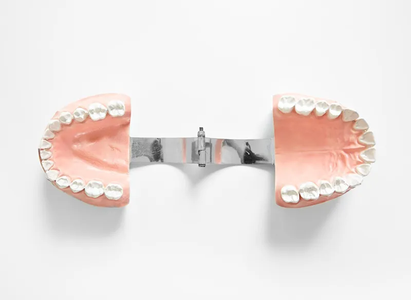 inflamed palate