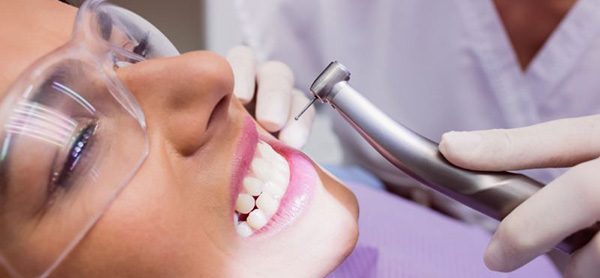limpiezas-dentales-en-bilbao-odontofamily
