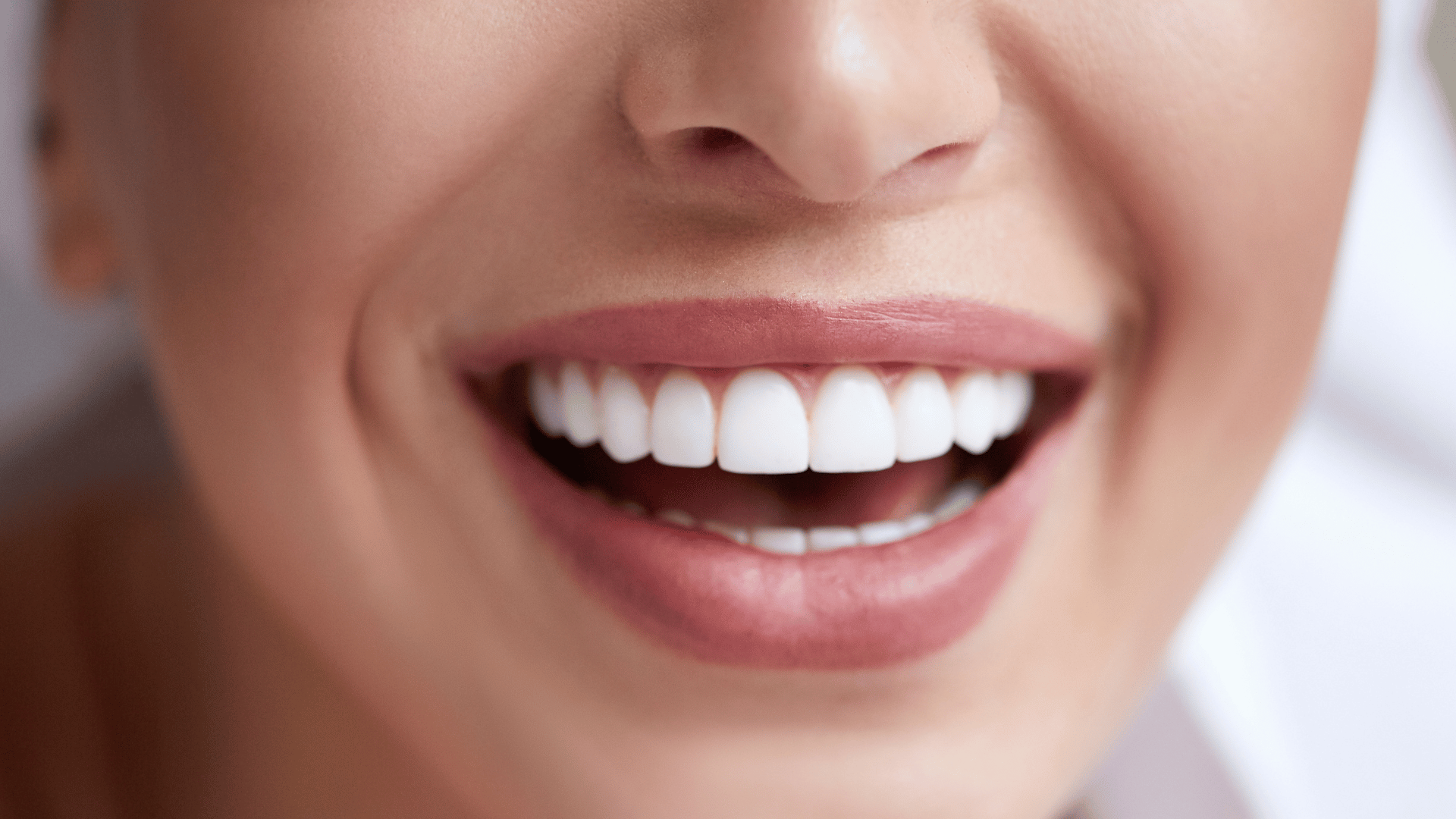 Tratamiento estética dental Bilbao