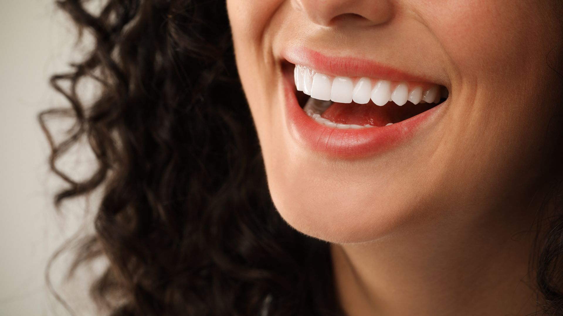 tratamiento carillas dentales en getxo