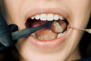diferencia entre Endodoncia y Periodoncia